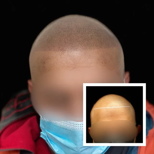 SMP Work before and after