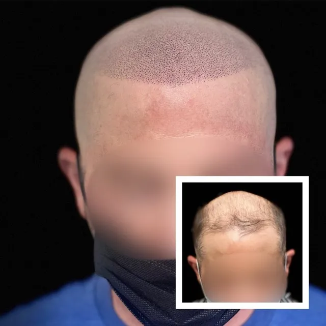 SMP Work before and after