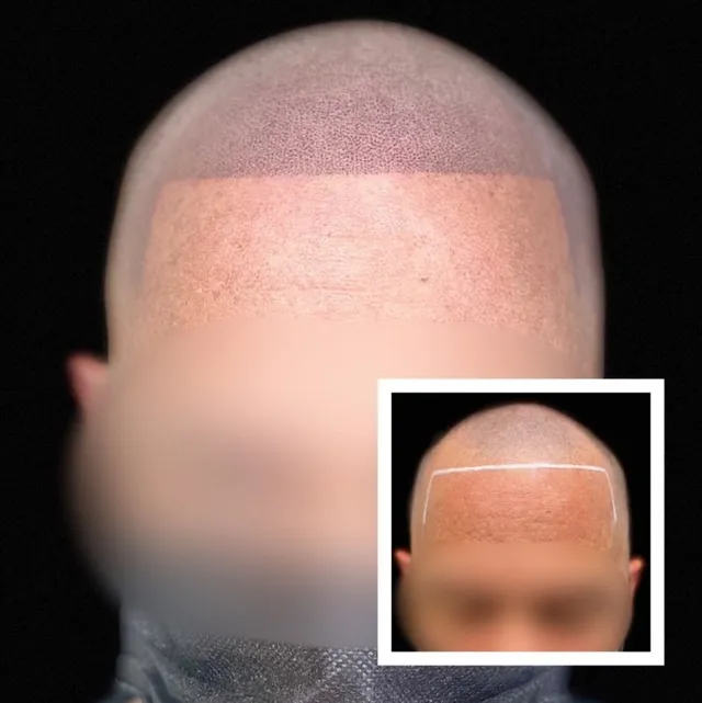 SMP Work before and after