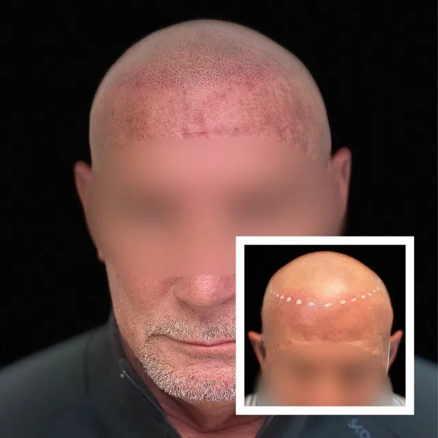 SMP Work before and after