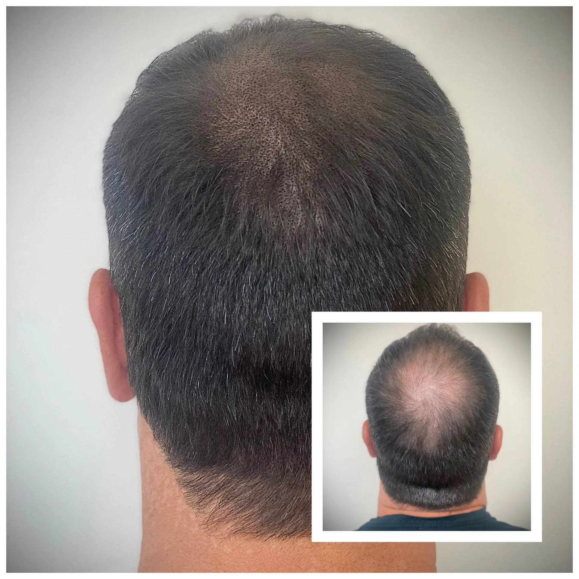 The back of a man 's head with a before and after picture