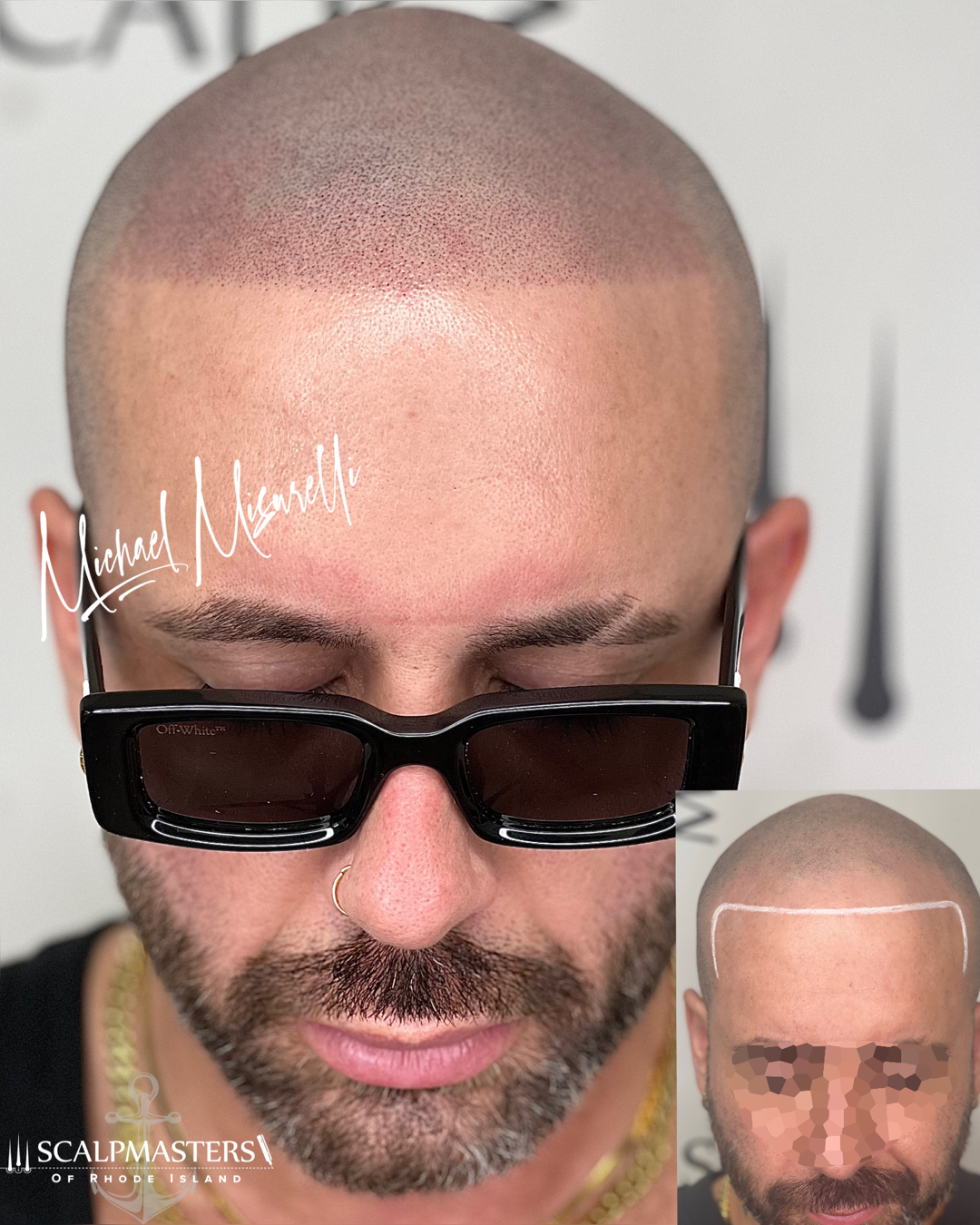 A bald man with a beard wearing sunglasses