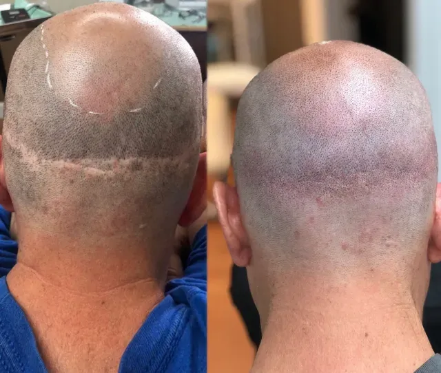 man with SMP work behind head