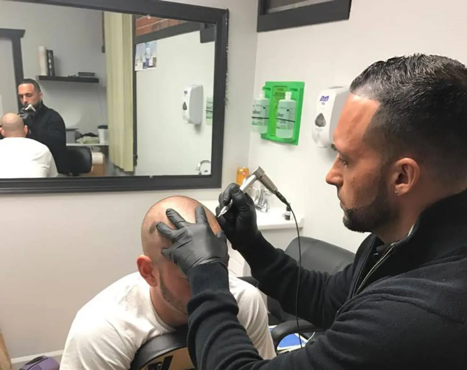Scalp Micropigmentation in Warwick, RI