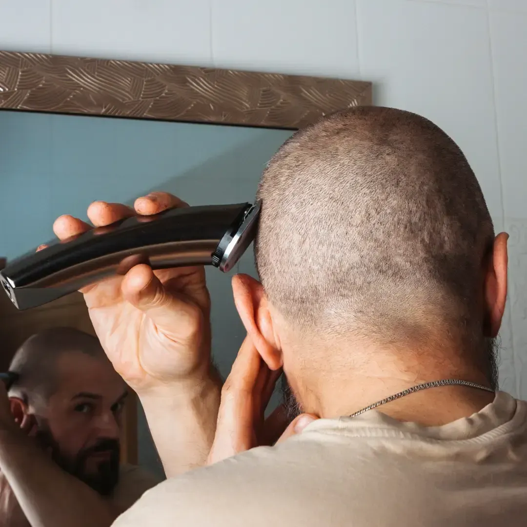 Scalp Micropigmentation Without Shaving Your Head