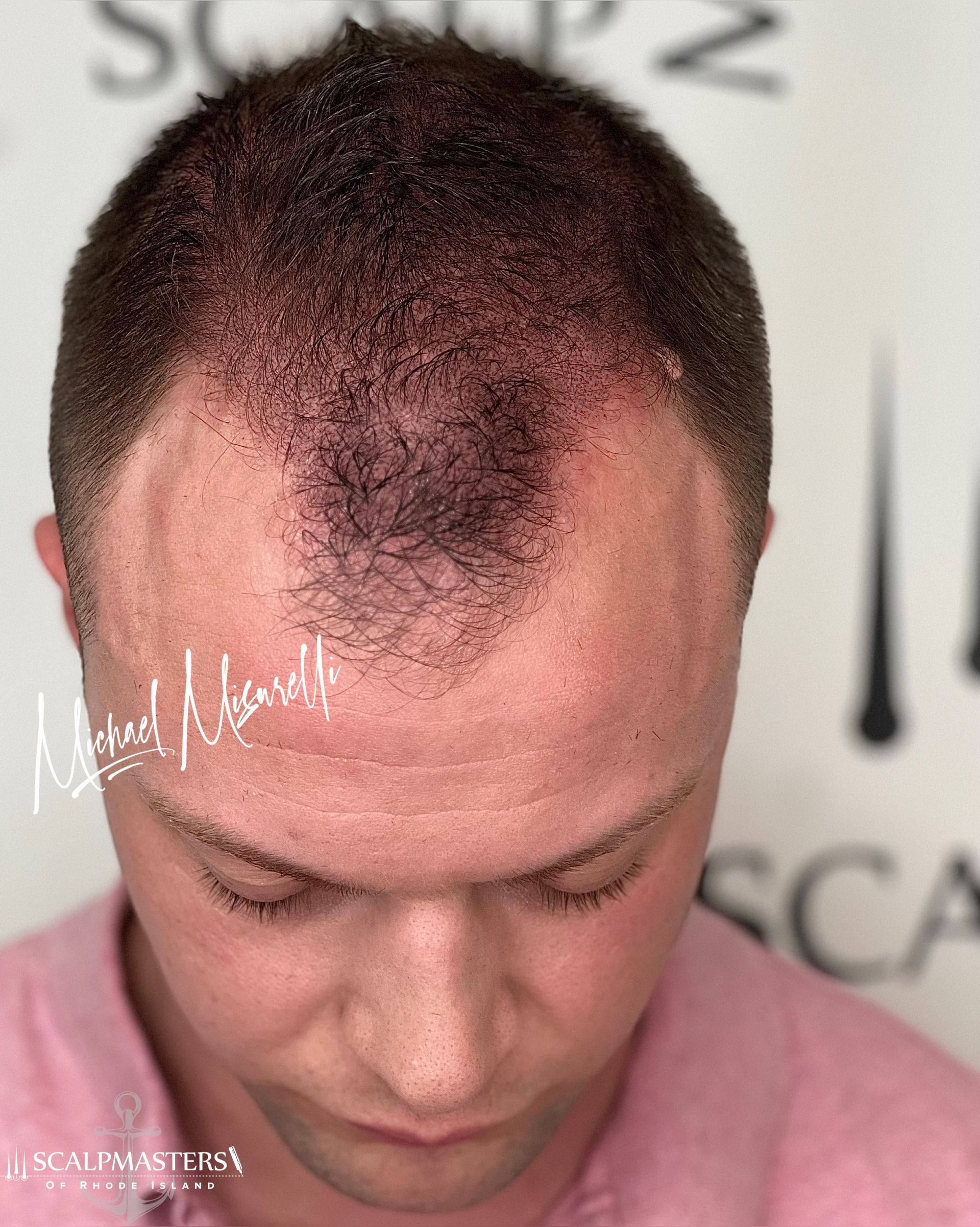 A man with a bald head is wearing a pink shirt.