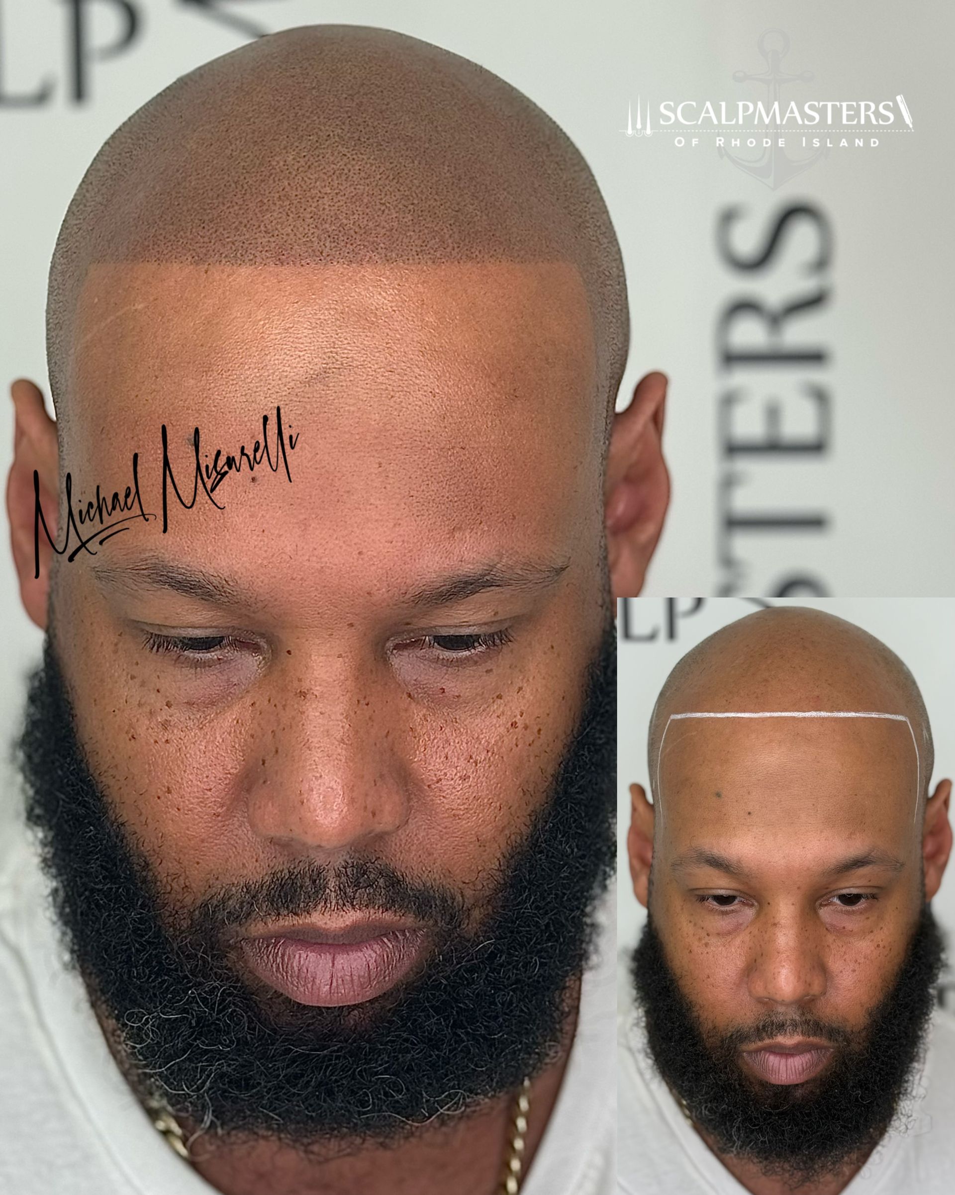 A man with a beard has a tattoo on his forehead