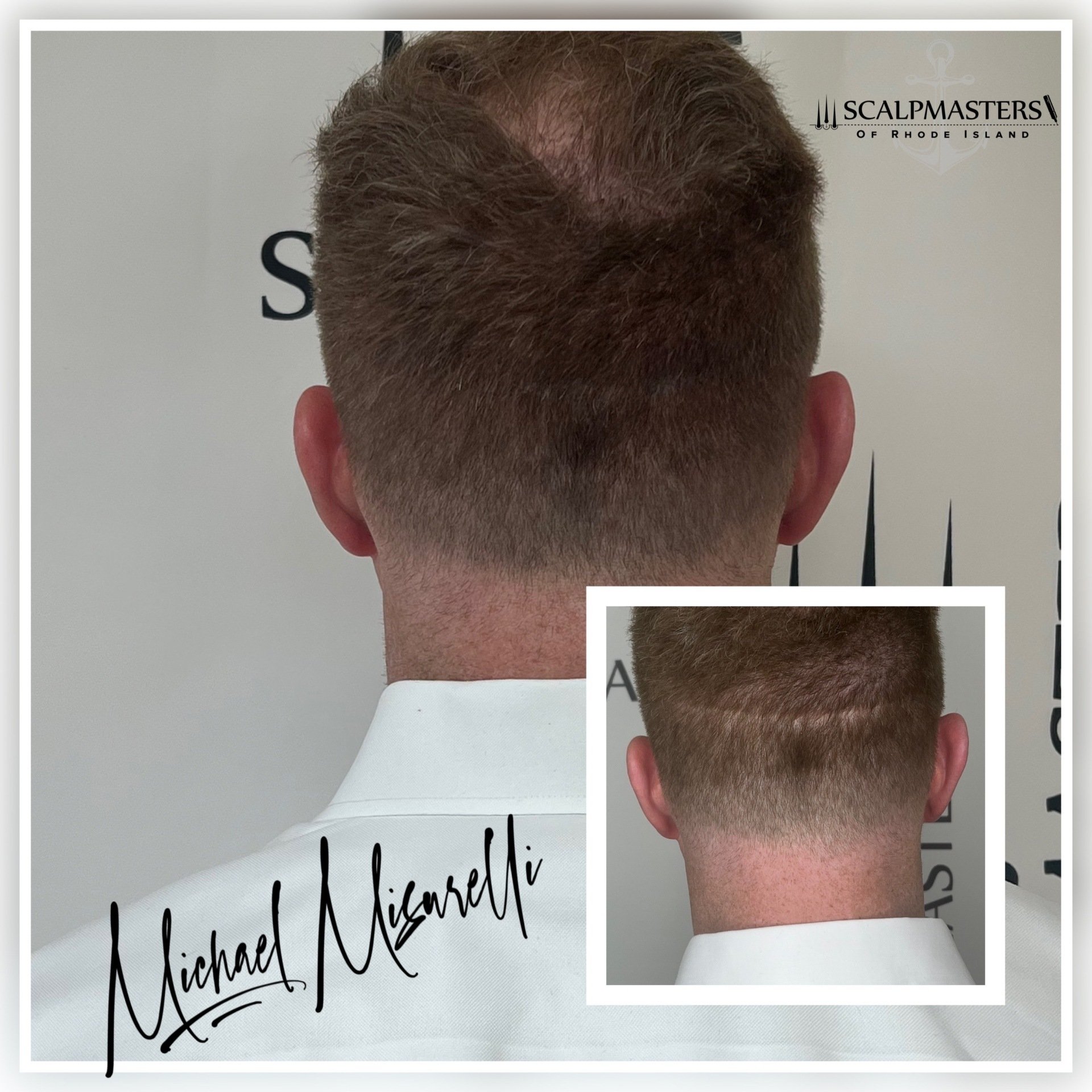 does cigarette cause hair fall Does Nicotine Cause Hair Loss? Understanding the Link