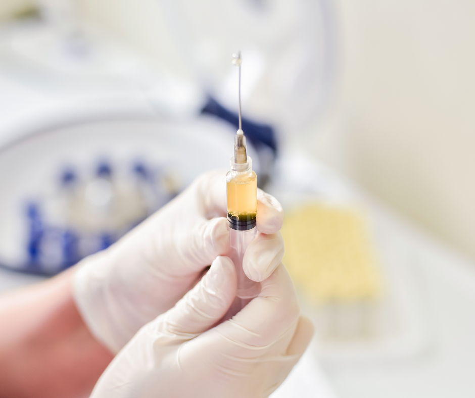 Platelet-Rich Plasma (PRP) | Rose Bank Sports Medicine and Therapy