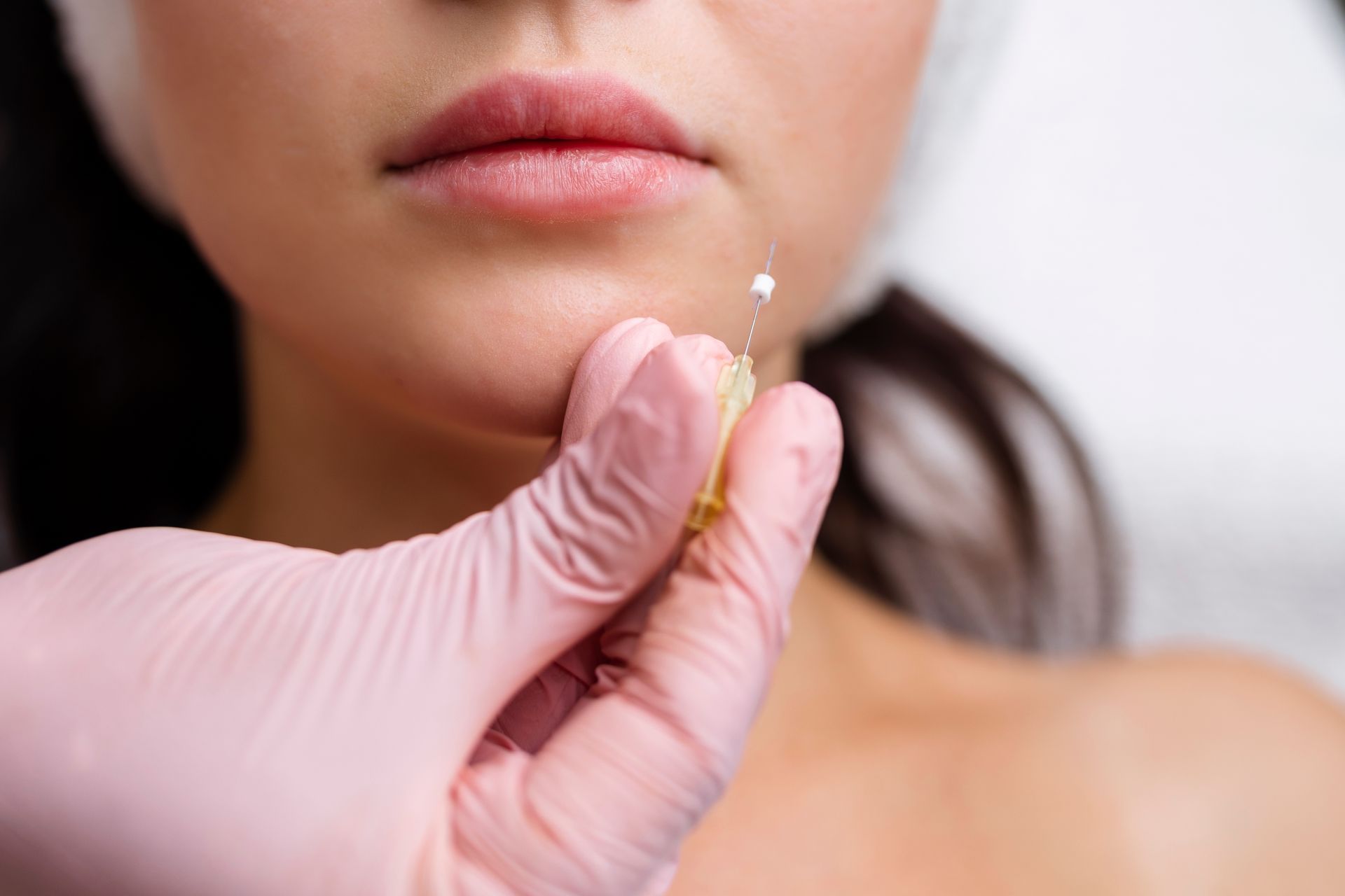 Gloved hand applying lip filler with a syringe to a woman’s lips, close-up.
