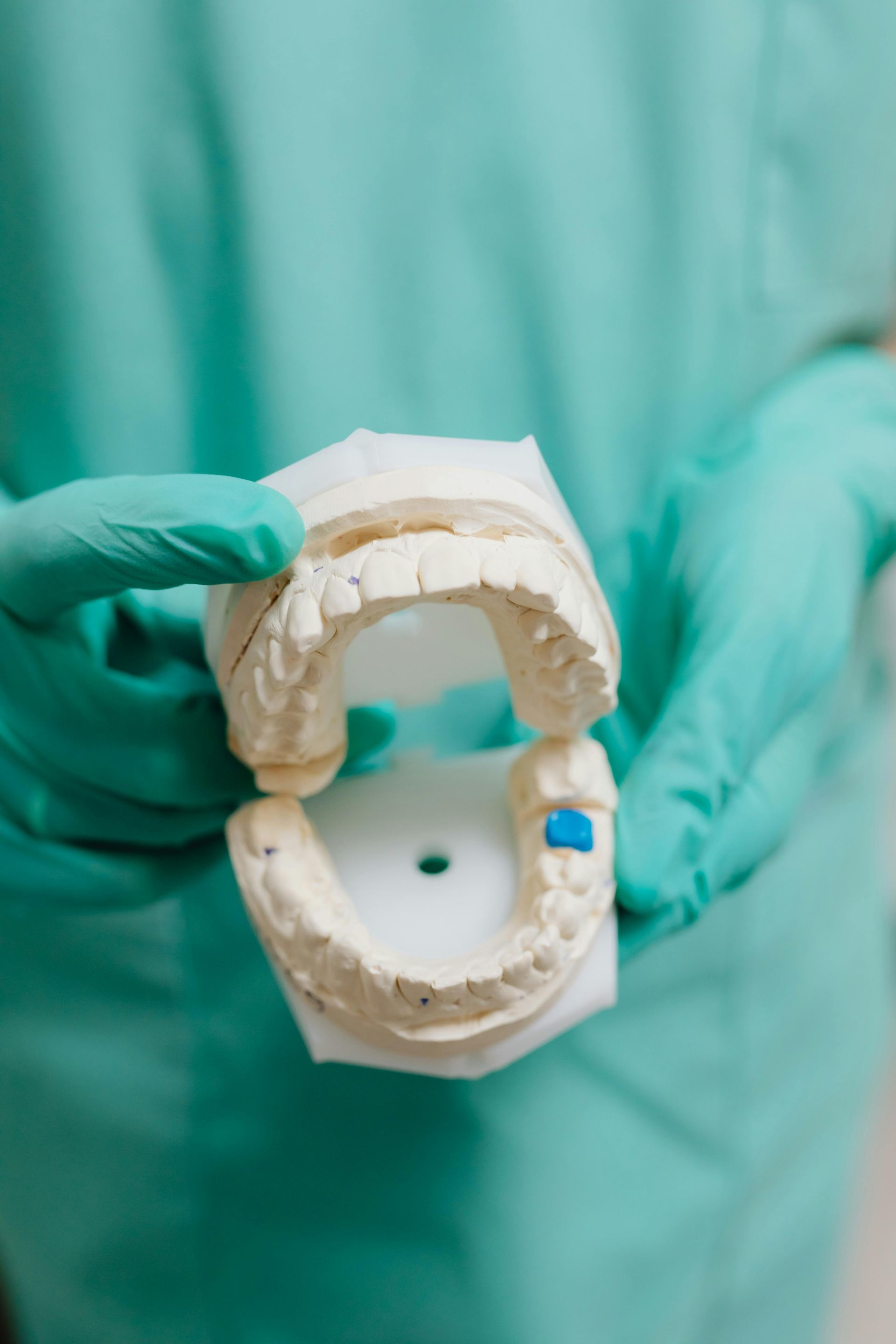 Mani guantate che reggono uno stampo dentale con un modello bianco e un punto di marcatura blu