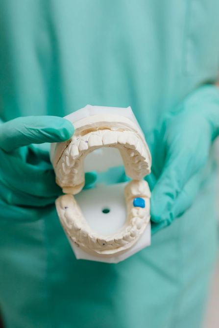 Mani guantate che reggono uno stampo dentale con un modello bianco e un punto di marcatura blu