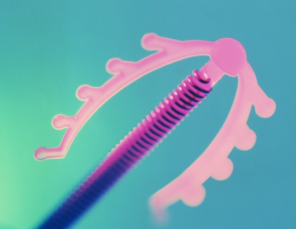 dispositivo anticoncezionale intrauterino