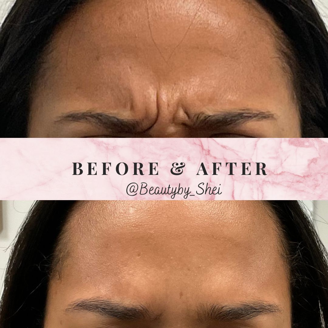 Before & After