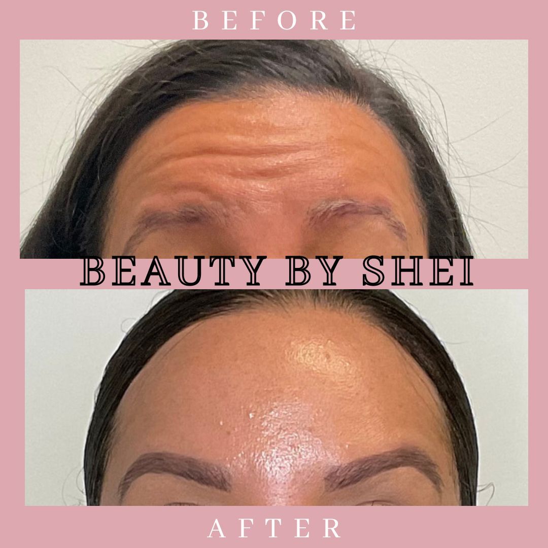 Before & After