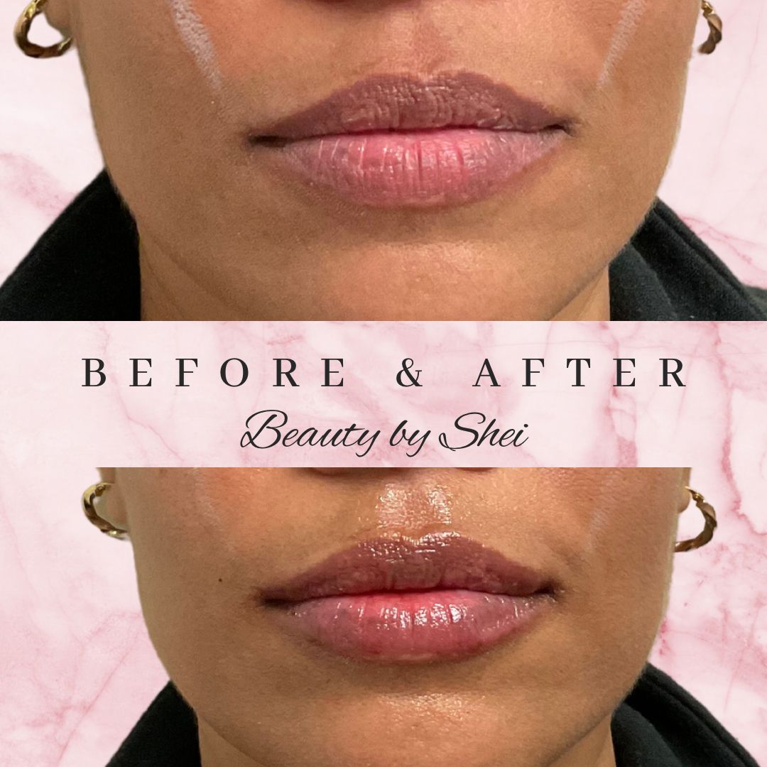 Before & After