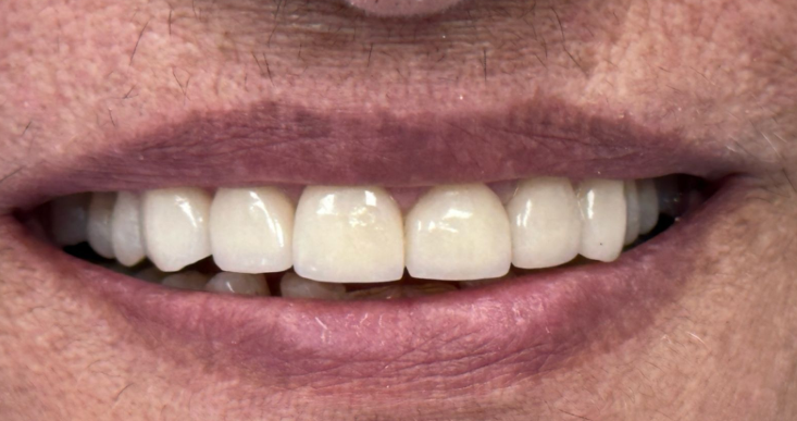 Close-up of a smiling mouth showing white teeth and pink lips