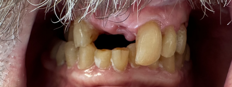 Close-up of a smiling mouth with a gap between the front teeth.