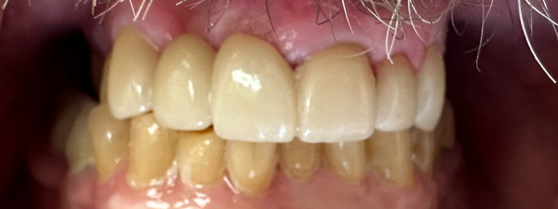 Close-up of a smiling mouth showing teeth and lips