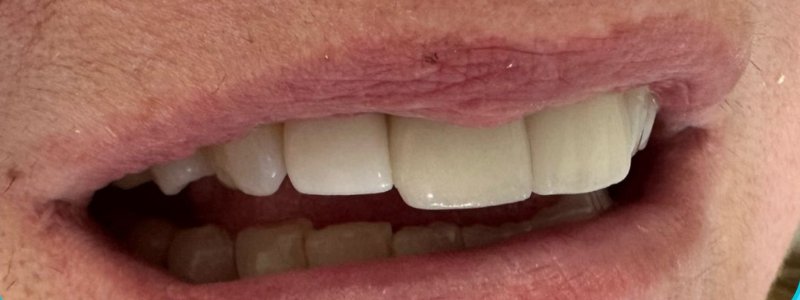 Close-up of a smiling mouth with slightly parted lips and white teeth