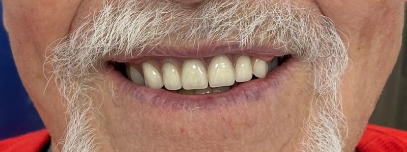 Close-up of a smiling mouth with white mustache and teeth against a blue background