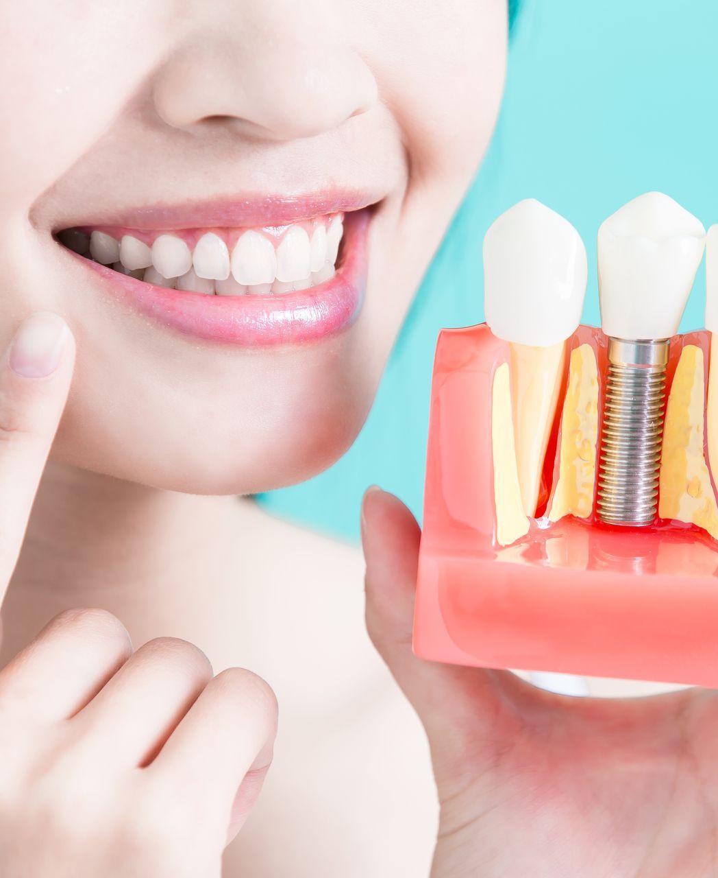 A woman is holding a model of a dental implant in her hand.