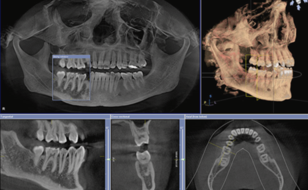 a skull and teeth are shown on a computer screen .