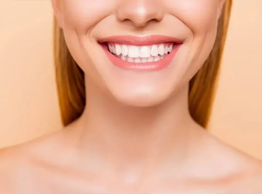 a close up of a woman 's smile with white teeth .