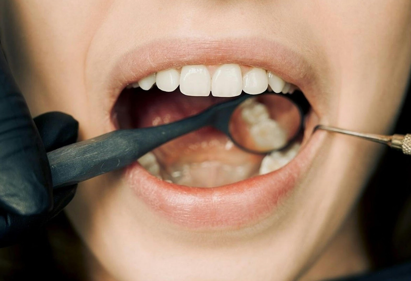 How to Manage Teeth Grinding | Gateway Family Dentistry