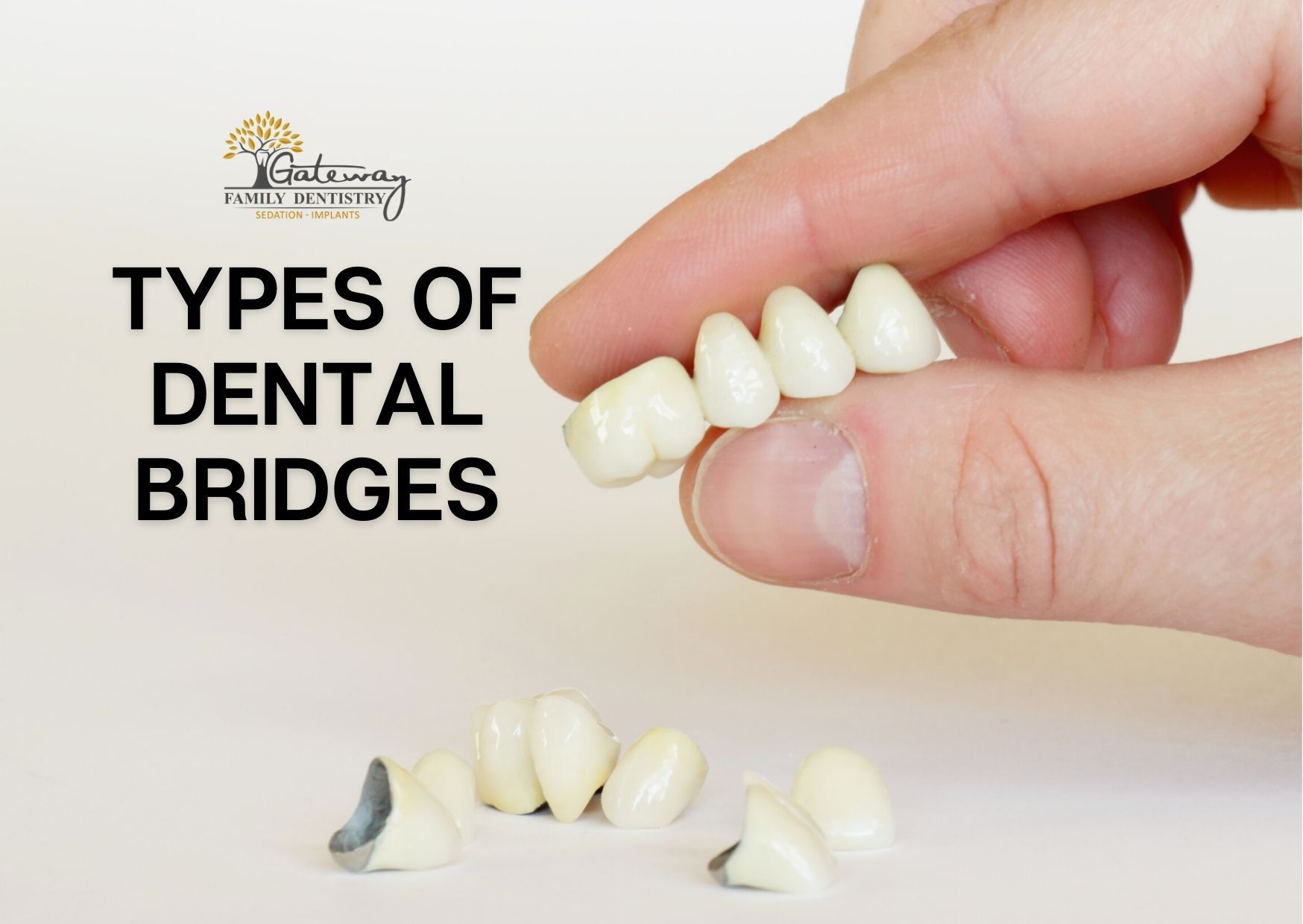 hand holding dental bridge