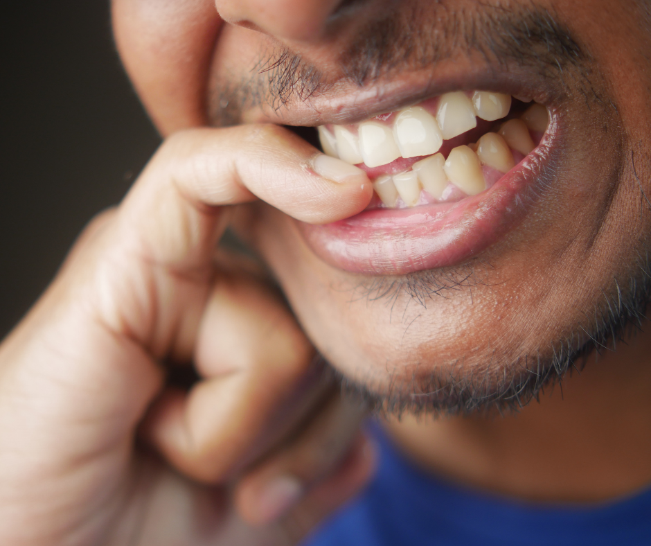 Habits to Avoid for Healthy Teeth | Gateway Family Dentistry