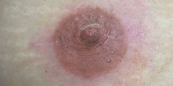 Nipple tattooing after 3