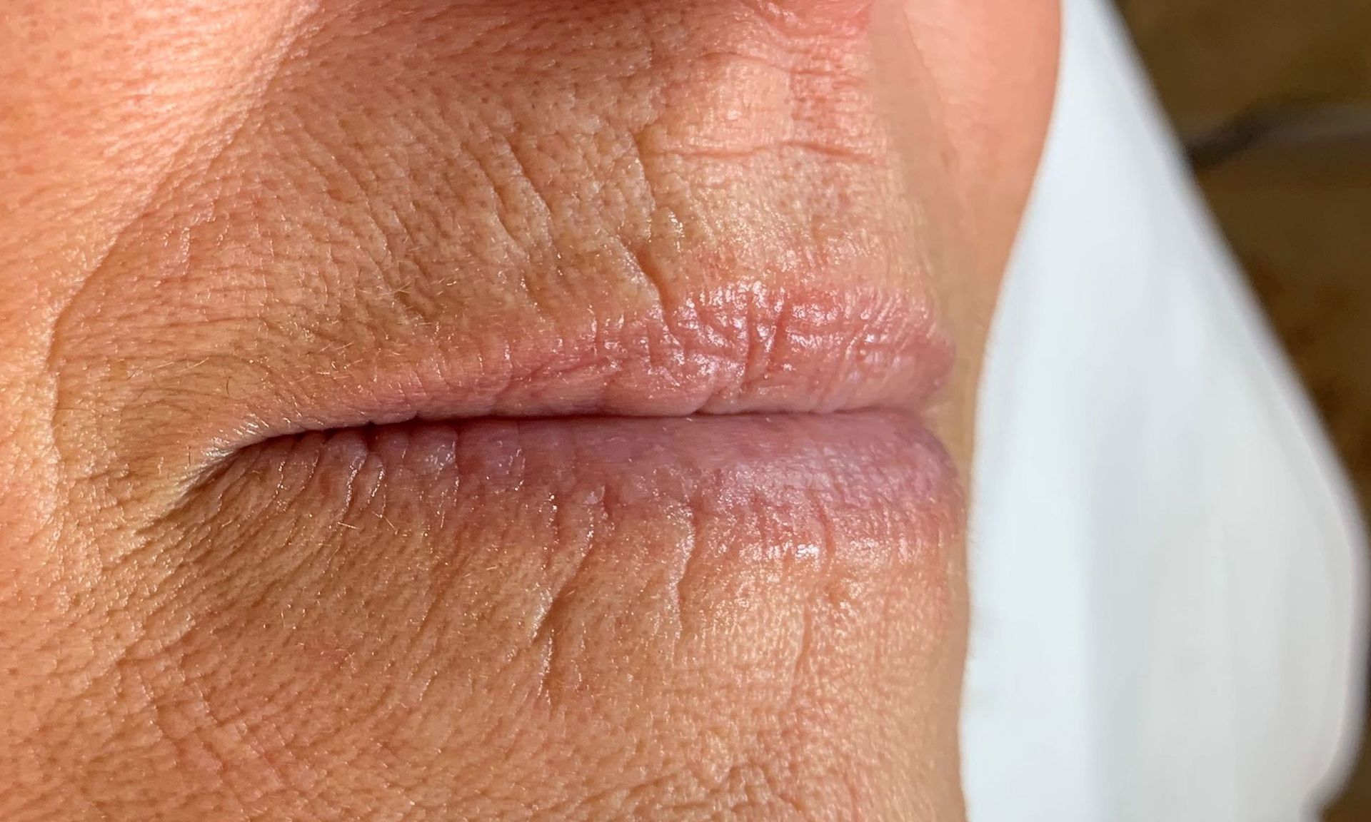 A close up of a woman 's lips with wrinkles.
