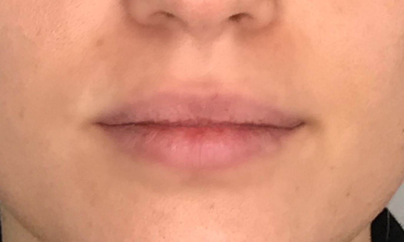 A close up of a woman 's lips and nose.
