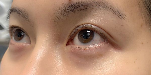 A close up of a woman 's eyes without makeup.