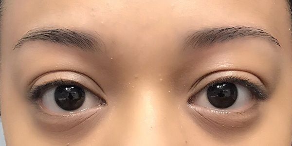 A close up of a woman 's eyes without makeup.