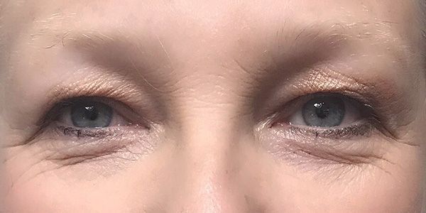 A close up of a woman 's blue eyes with wrinkles.