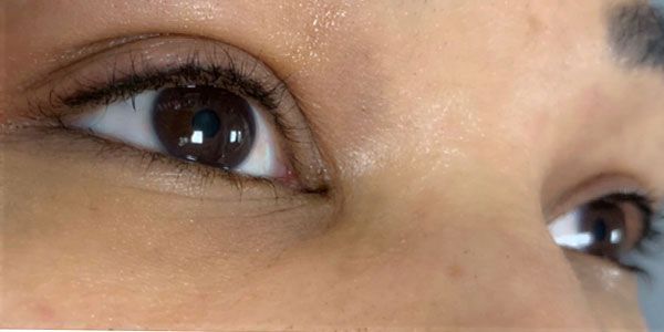 A close up of a woman 's eye with a white pupil.