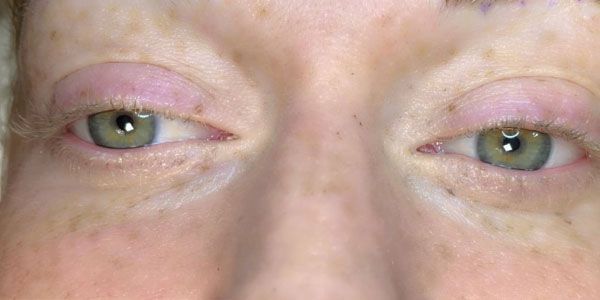 A close up of a woman 's green eyes with pink eyelids.