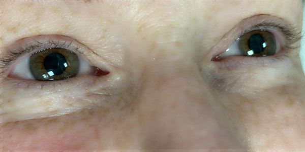 A close up of a woman 's eyes with a very sparse eyebrow.
