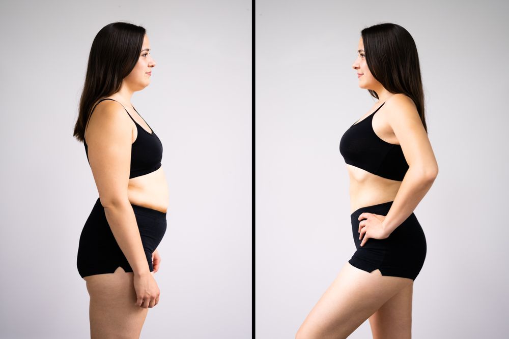 A before and after picture of a woman 's stomach.