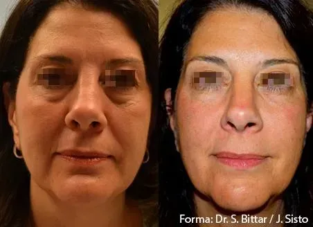forma - Coastal Ketamine & Aesthetics charleston, south carolina