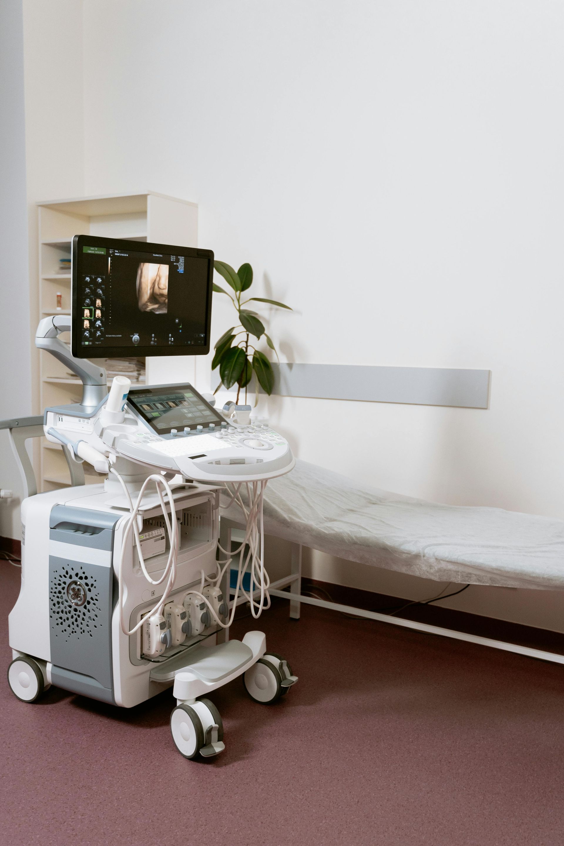 Ultrasound machine in medical room next to an examination table.