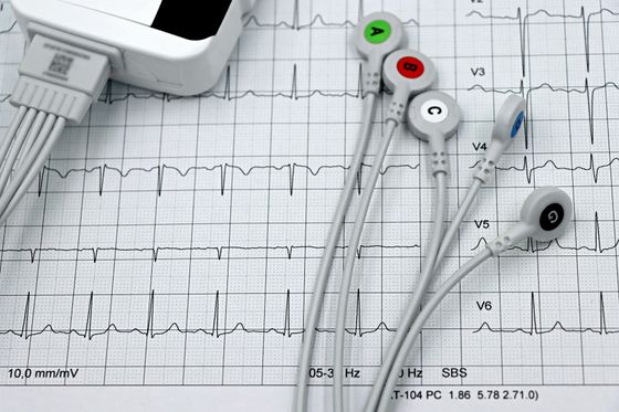 ECG printout with three medical electrodes and a syringe on a white table