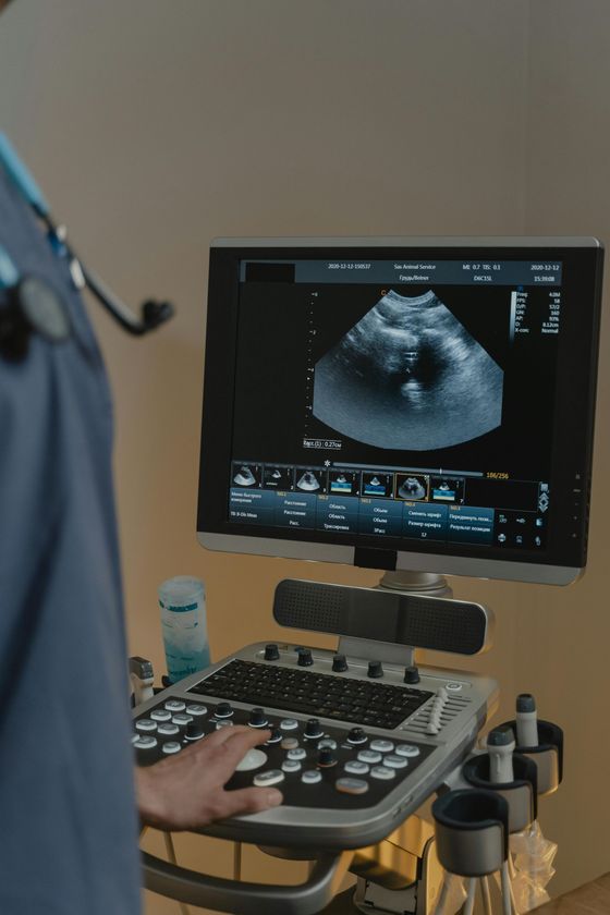 Ultrasound machine displaying a fetal scan, with a clinician’s hand on the control panel.