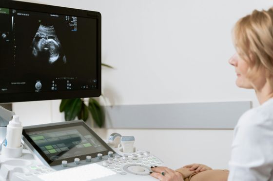 Medical staff viewing an ultrasound scan on a monitor in a bright clinic room
