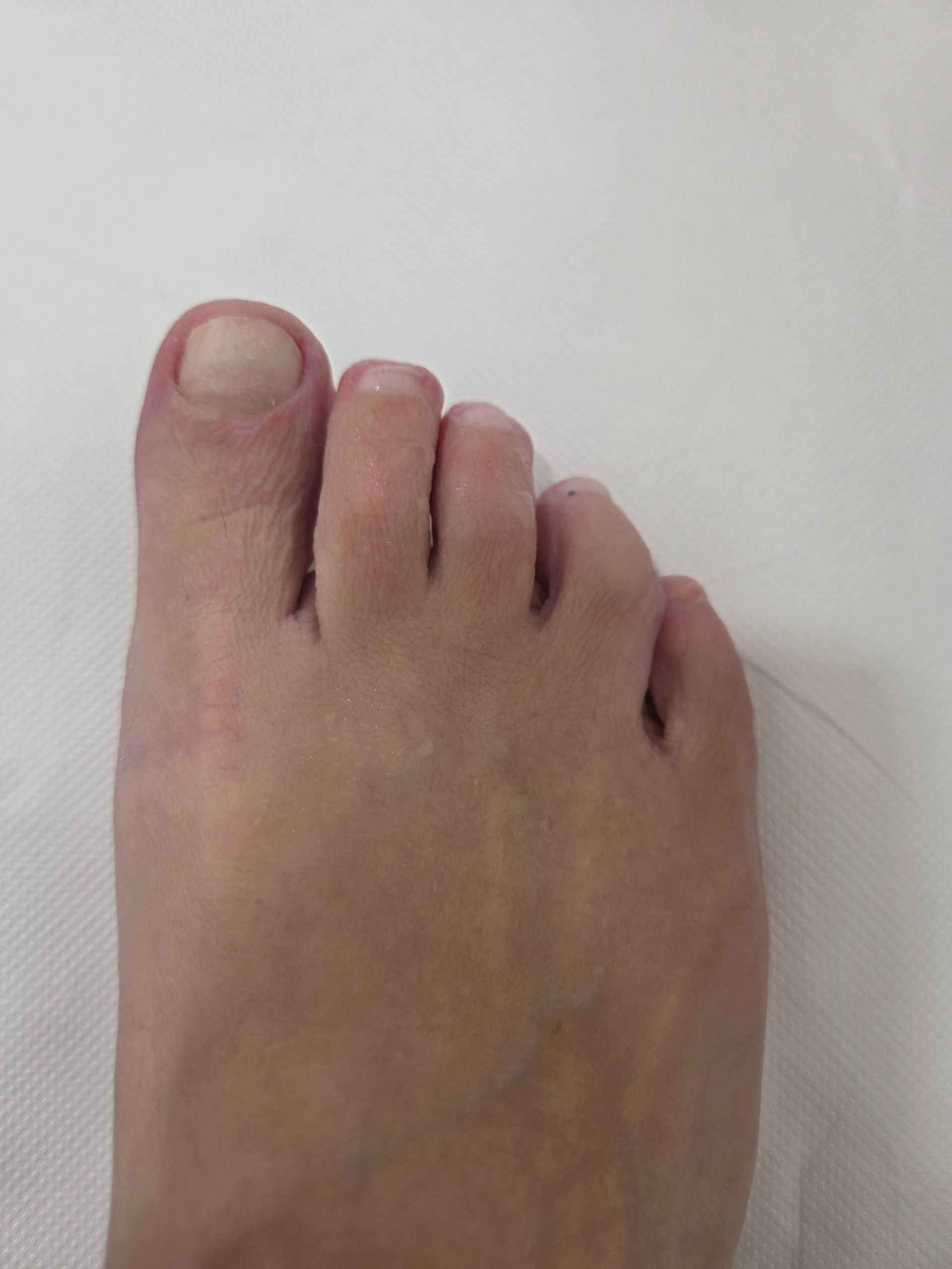pedicure Orbassano