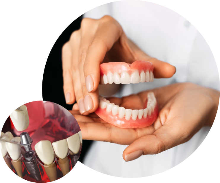 dental implant 3