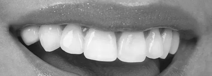 Close-up of a smile with a gap between the front teeth near Southampton