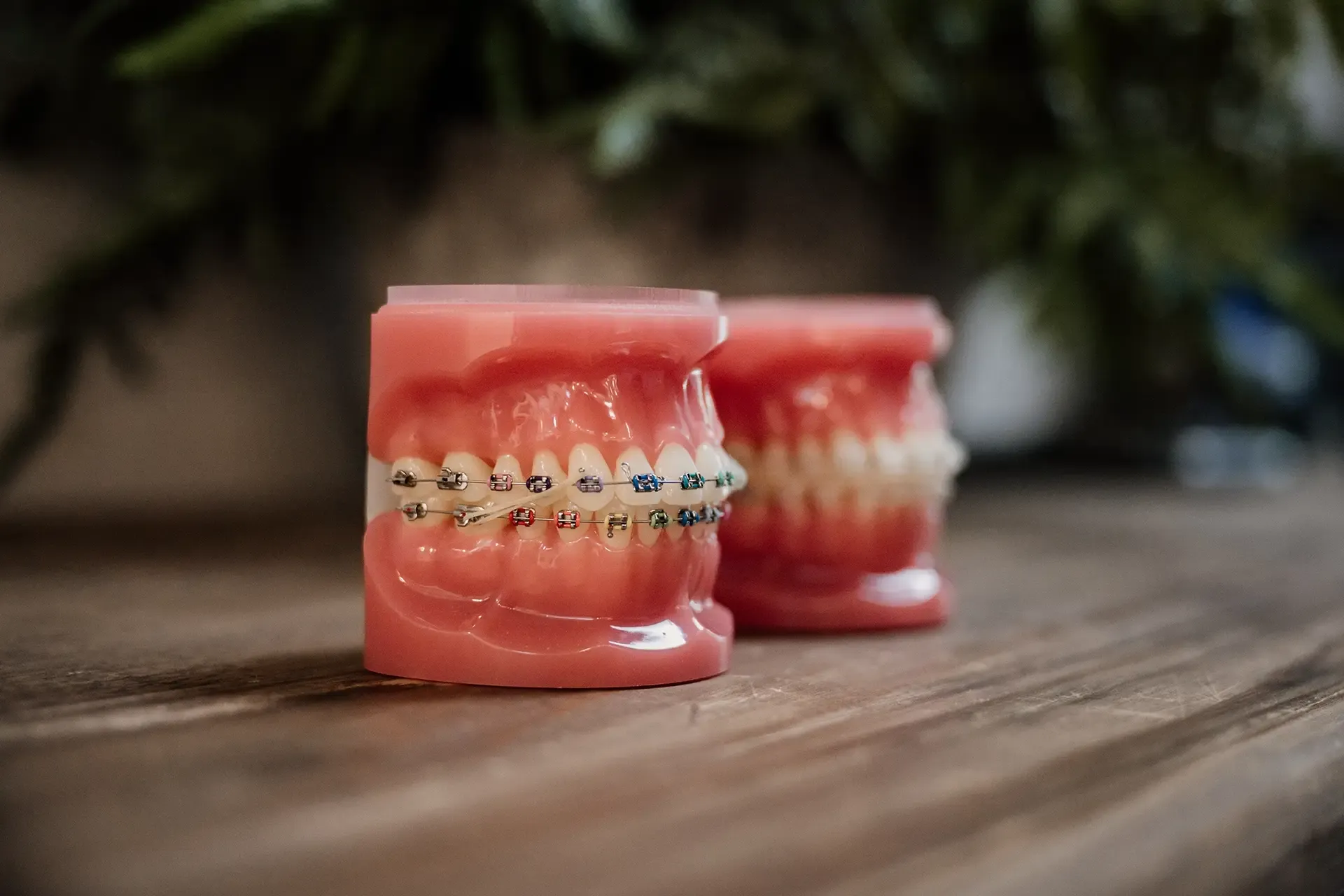 Olliver Orthodontics in Blenheim, Marlborough NZ. We offer both metal and ceramic (clear) options for braces, as well as aligner treatments such as Spark and Invisalign.